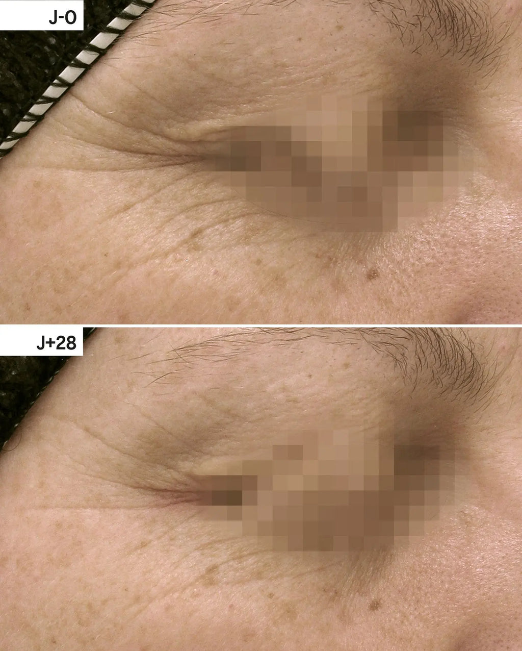 CAPSULES REPAIR lightinderm